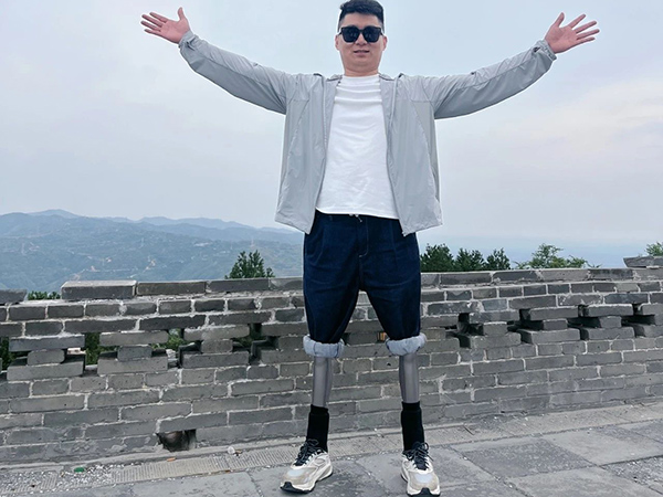 雙腿肢友故事之大佳，樂觀人生不設限！
