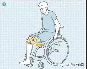 假肢公司